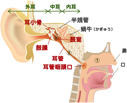 急性中耳炎