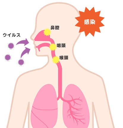 かぜ